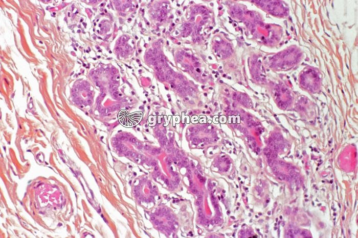 Glande mammaire x70 - gryphea.com